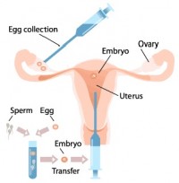 Image result for gift fertilization